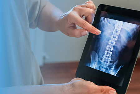 Close-up of a person holding a tablet displaying a spinal x-ray
