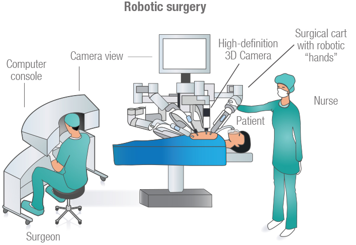 Diagram illustrating a robotic-assisted surgery on a patient, showcasing robotic arms and surgical tools in action