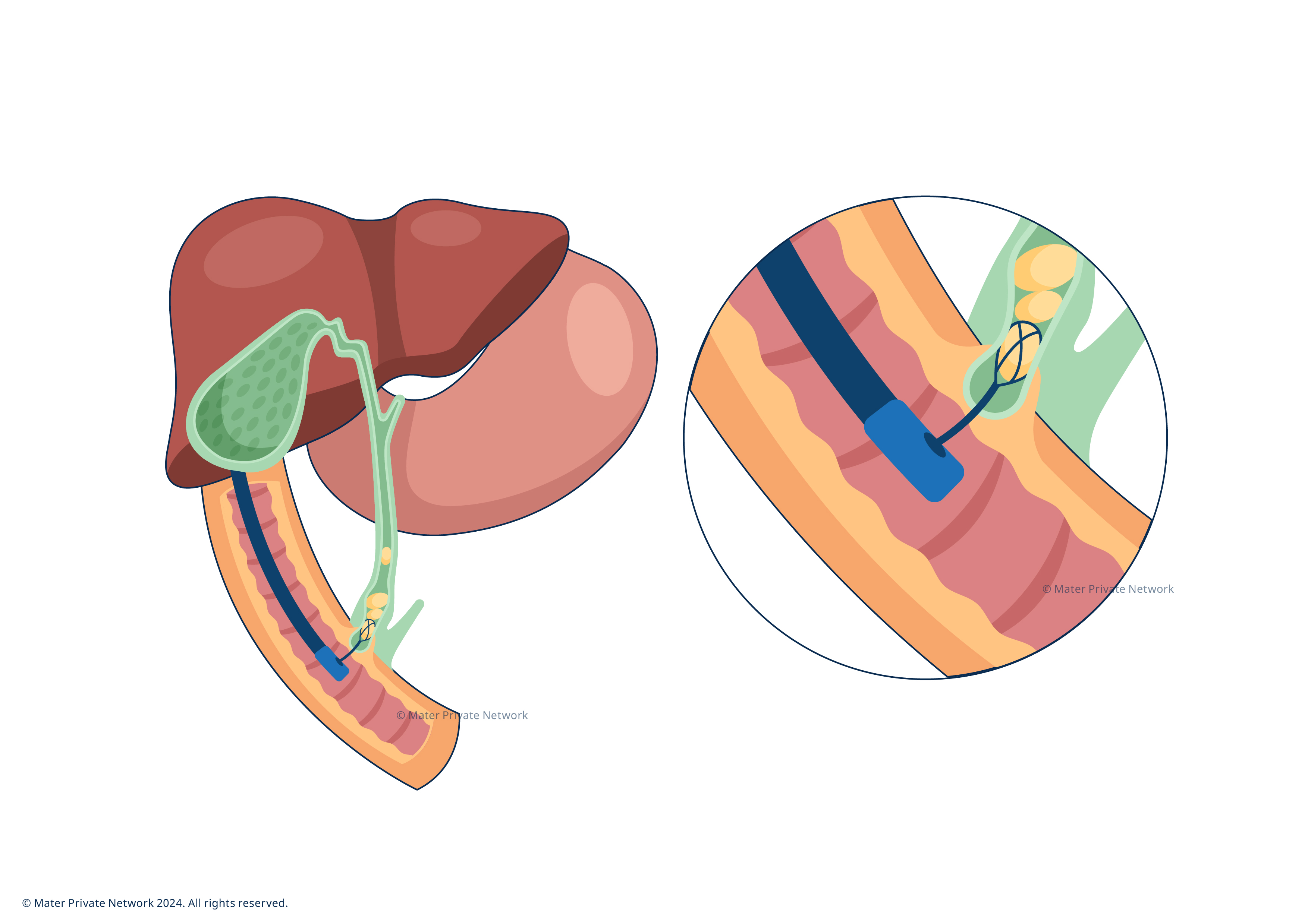 2078 ERCP images FA-02