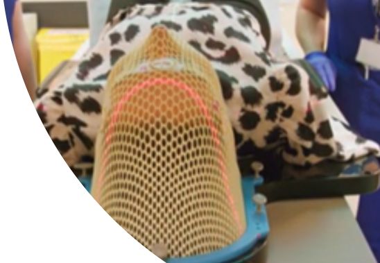 Radiotherapy - spotlight